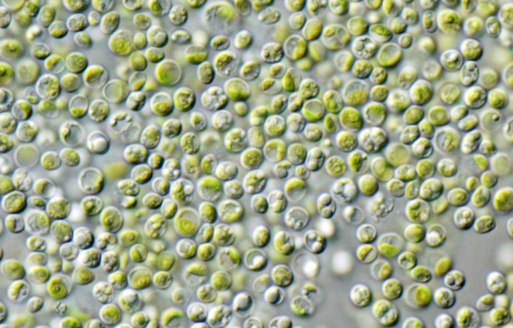 The New Algae Virus That Can Live in Your Throat and Affect Your Brain